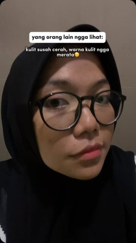 PostPhoto