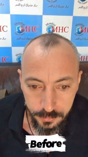Video post from mondialhaircenter.