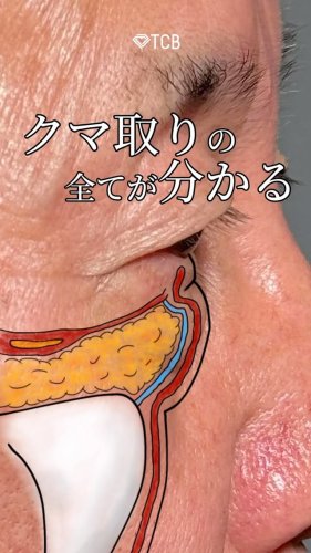 Video post from tcb_kurashima.