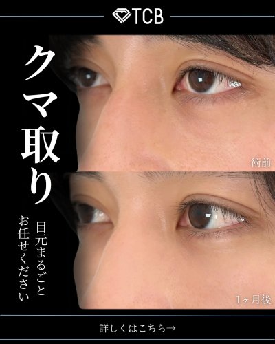 Carousel post from tcb_matsumura.