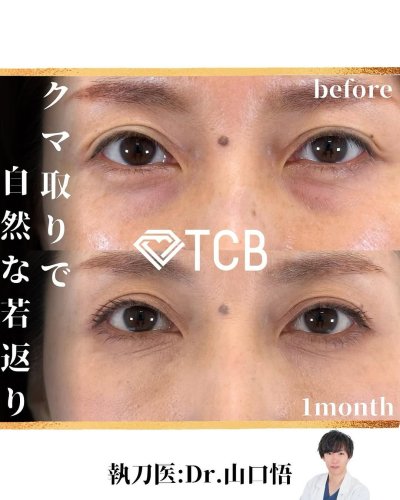 Carousel post from tcb_yamaguchi.s.