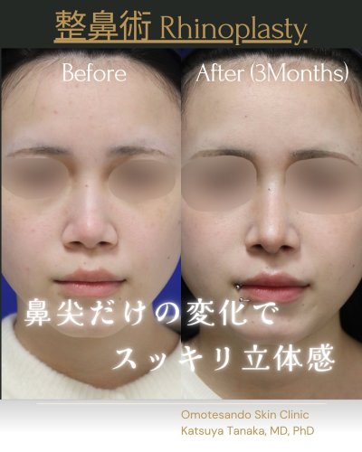 田中 克弥 医師 | 美容外科・美容皮膚科なら表参道スキンクリニック