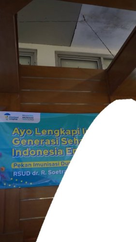Video post from soetrasno_rs.