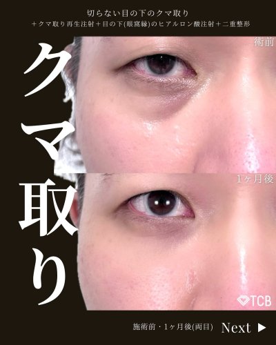 Carousel post from tcb_koga_tadanori.