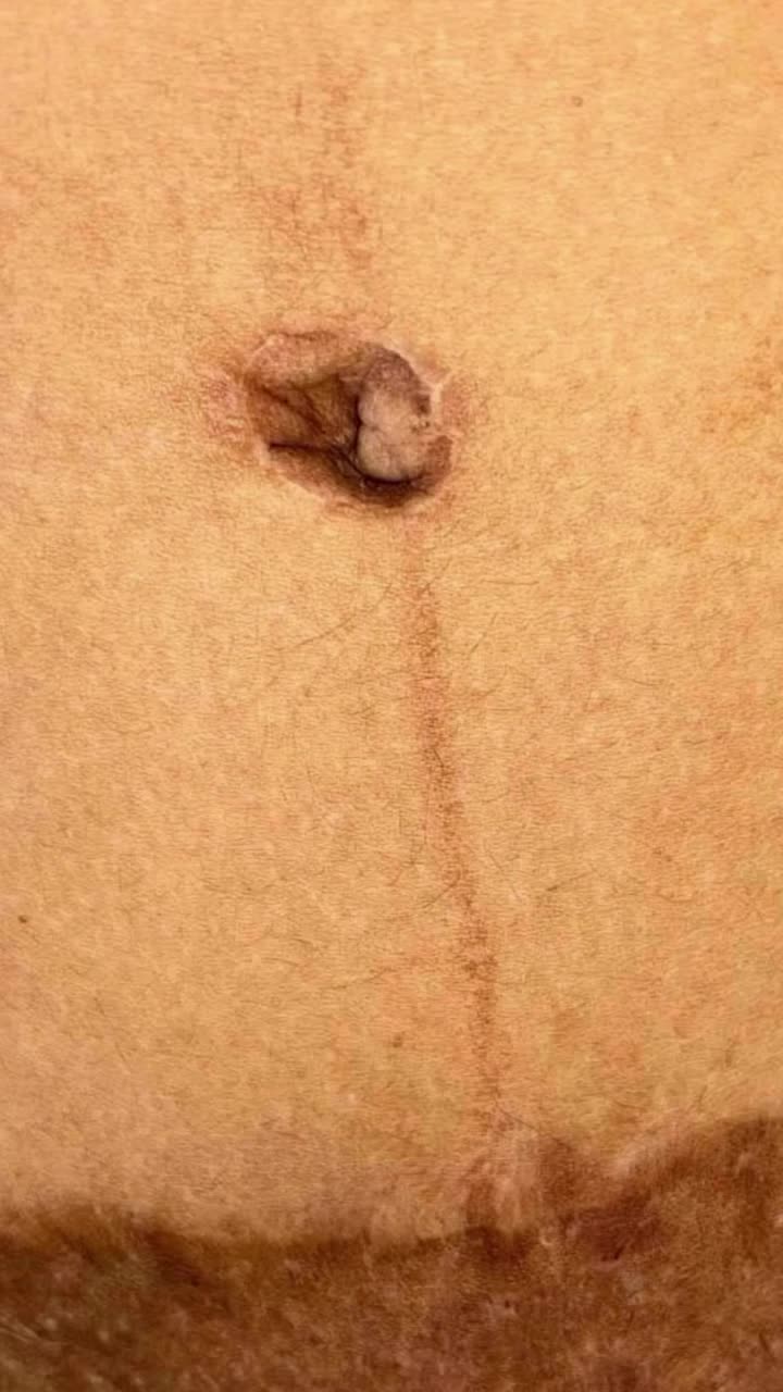Video post from richbichclinic.