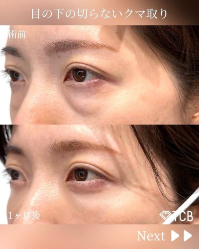 Carousel post from tcb_sano_eiki_.