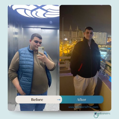 Photo post from antbariatric.