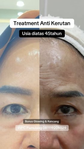 PostPhoto