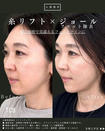 Carousel post from tcb_yamada.