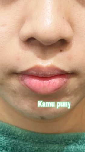 PostPhoto