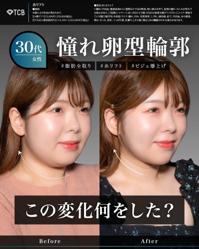 Carousel post from tcb_okamoto_takuya_shorei.