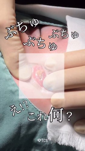 Video post from tcb_terato.