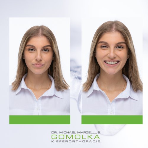 Photo post from dr.gomolka.
