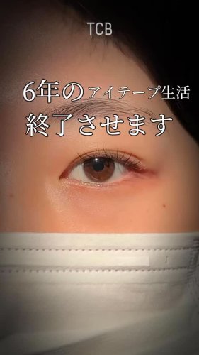 Video post from tcb_kabuto.