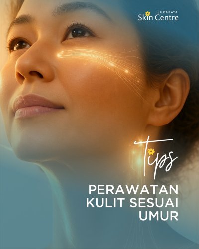PostPhoto