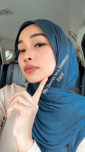 PostPhoto