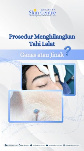PostPhoto