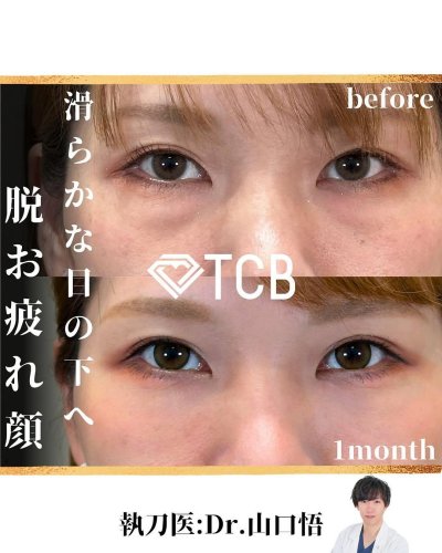 Carousel post from tcb_yamaguchi.s.