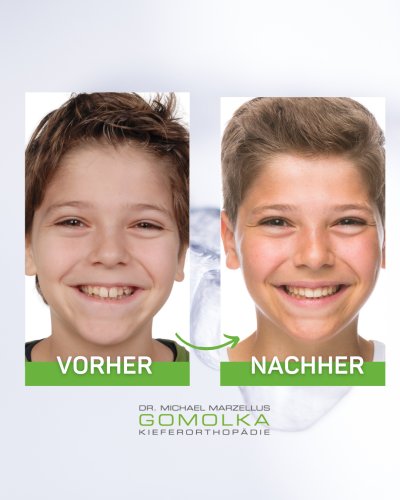 Photo post from dr.gomolka.