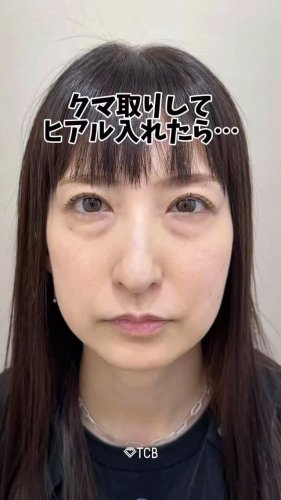 Video post from tcb_shinonaga.