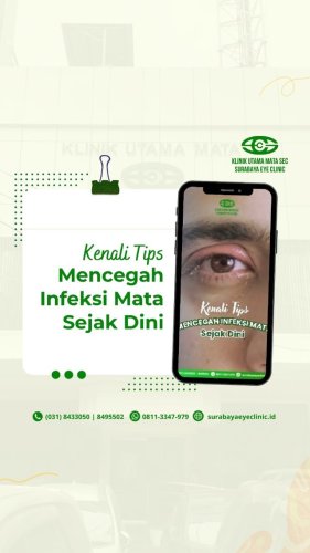 PostPhoto