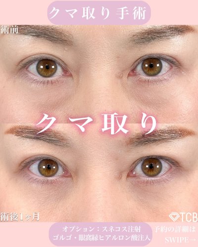 Carousel post from tcb_muraoka_futae.