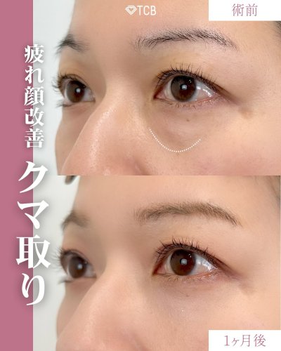 Carousel post from tcb_sakamoto.
