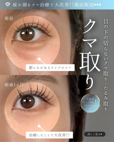 Carousel post from tcb_watanabe_masashi.