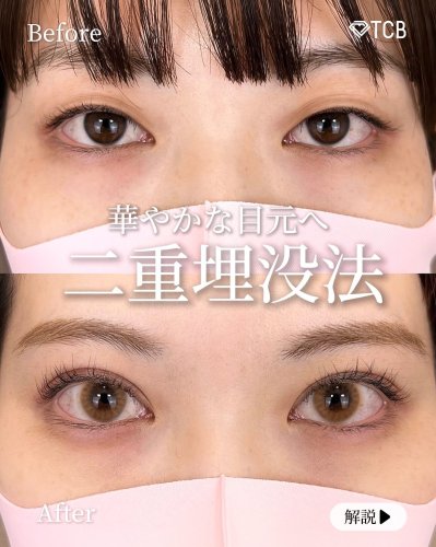 Carousel post from tcb_kurashima_futae.