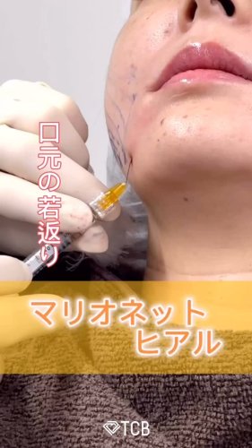 Video post from tcb_sano_eiki_.