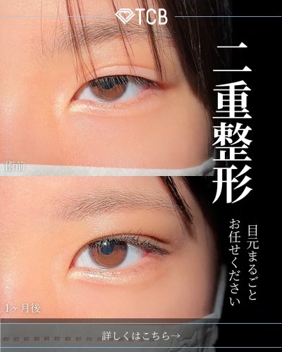 Carousel post from tcb_matsumura.