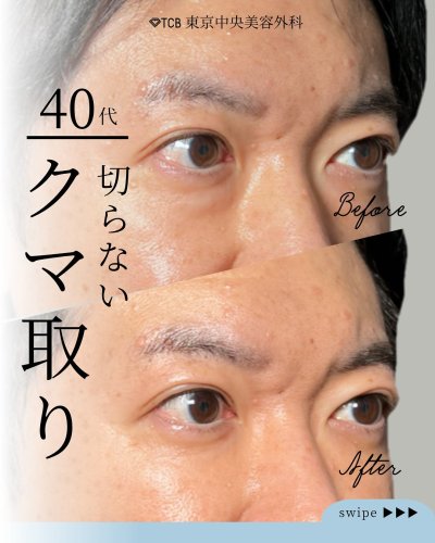 Carousel post from tcb.kawashima.