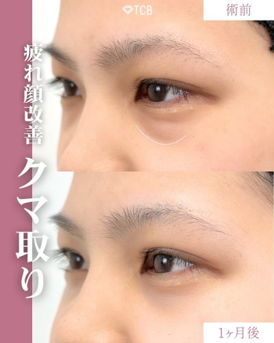 Carousel post from tcb_sakamoto.