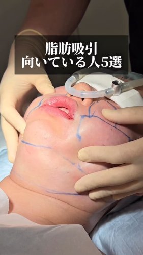 Video post from tcb_omi.