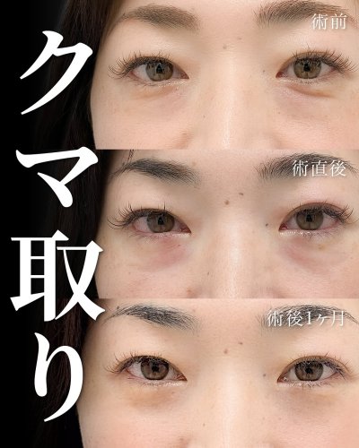 Carousel post from tcb_sakamoto.