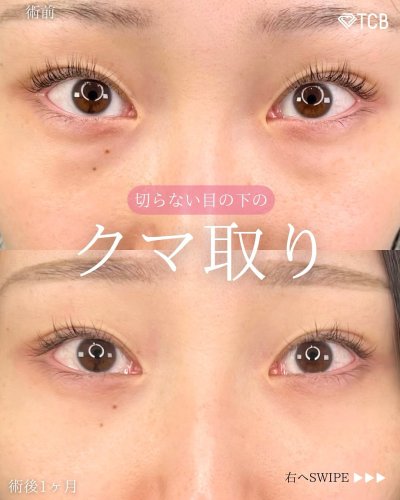 Carousel post from tcb_sayo_terao.