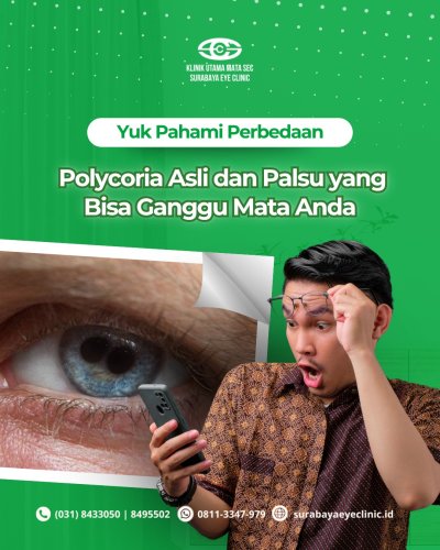 PostPhoto