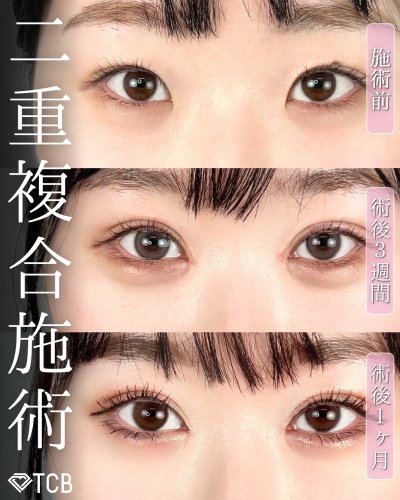 Carousel post from tcb_kuribayashi.