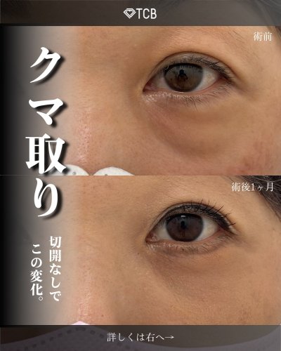 Carousel post from tcb_okumura_shun.