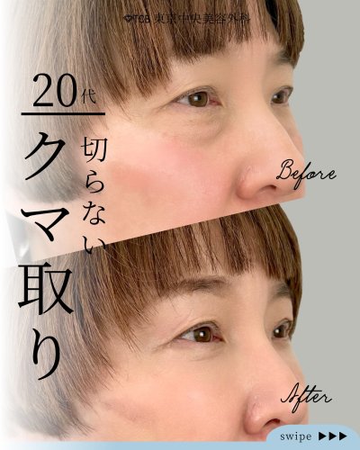 Carousel post from tcb_hashimoto.