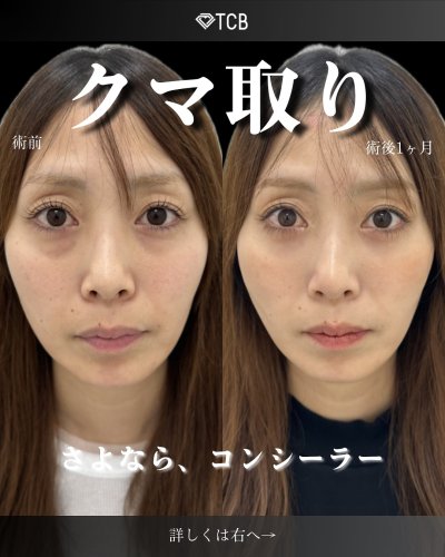 Carousel post from tcb_okumura_shun.