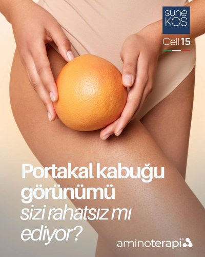 PostPhoto