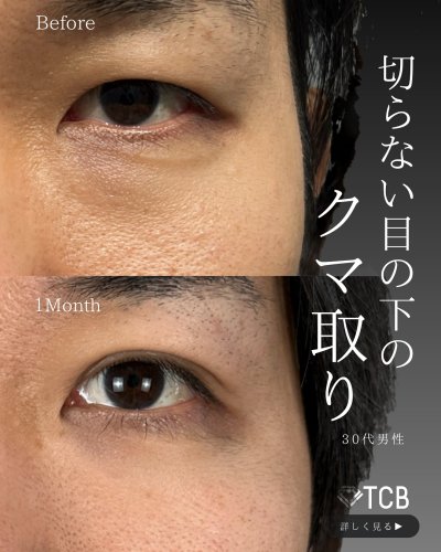 Carousel post from tcb_kamata_shorei.