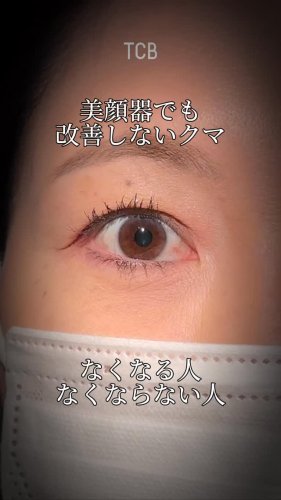 Video post from tcb_kabuto.