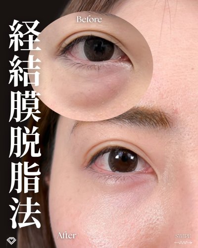 Carousel post from tcb_watanabe.shiori.