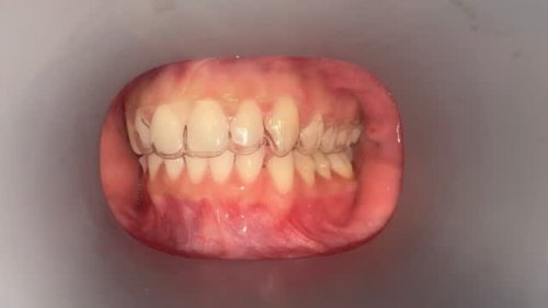 Video post from trilliumdental.