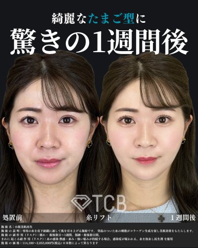 Carousel post from tcb_yamamoto.