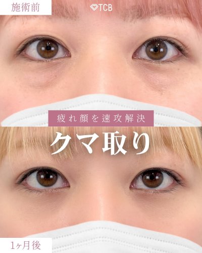 Carousel post from tcb_sakamoto.