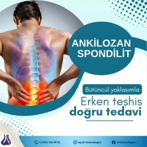 Video post from op.dr.hasandogan.