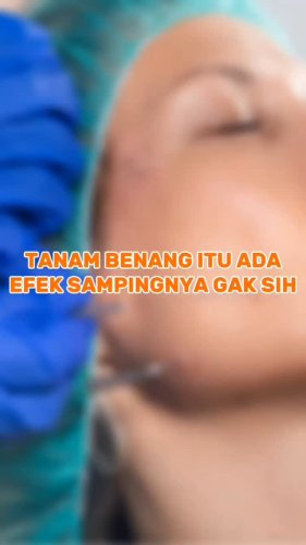 PostPhoto